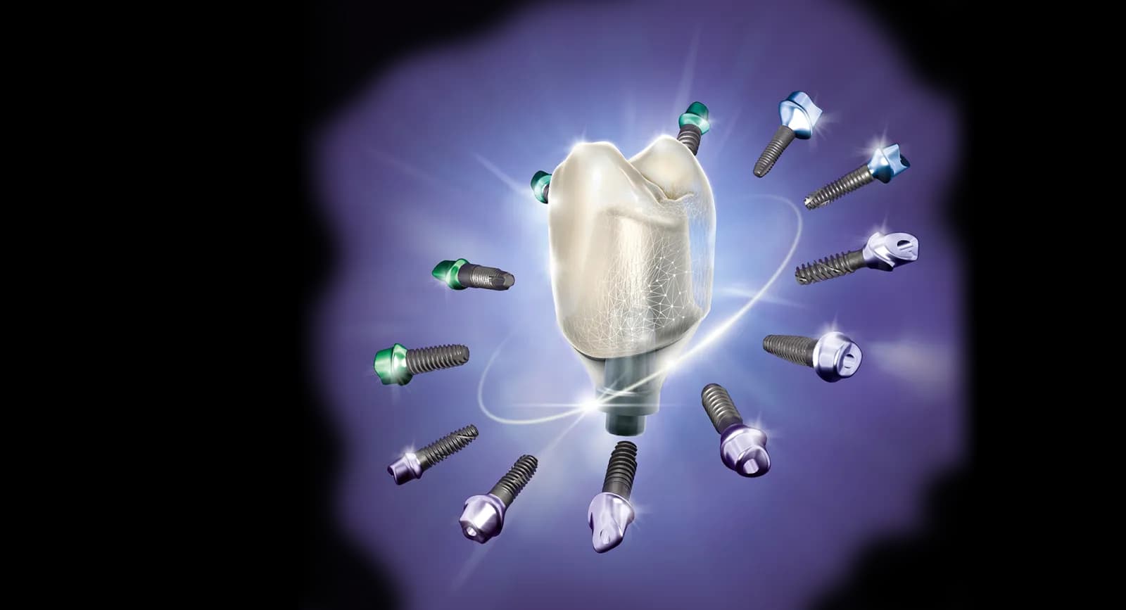 Exocad DentalCAD 3.3 Chemnitz — dizajn dentalnog rada na ekranu